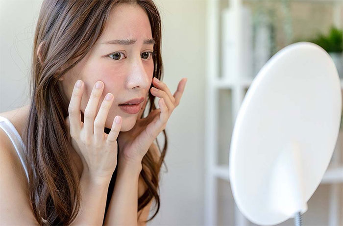 4 Most Common Skin Problems That Singapore Women Face