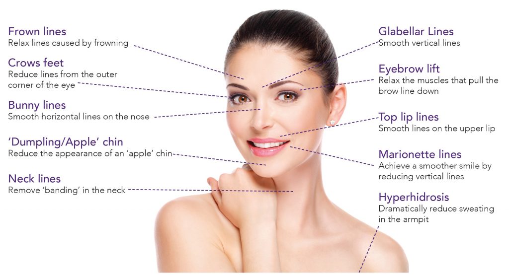 Botox Treatment Areas