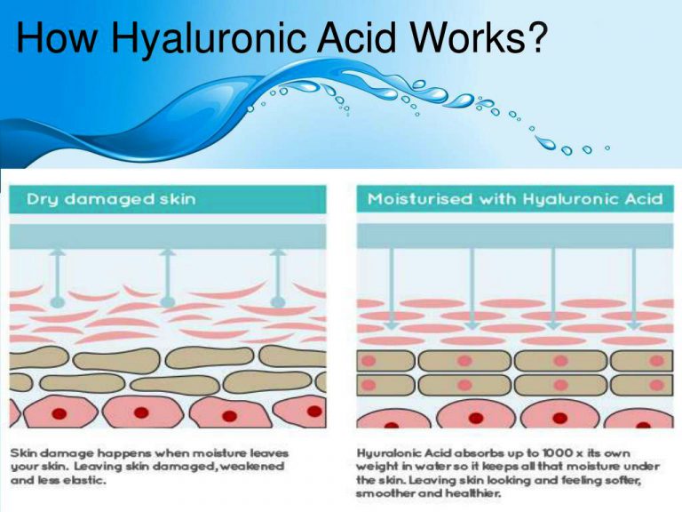 how-hyaluronic-acid-works