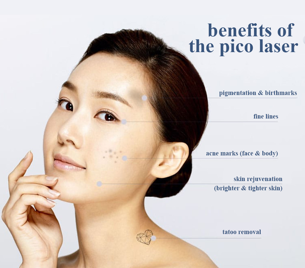 Benefits of PICO Laser treatment by PicoLO?