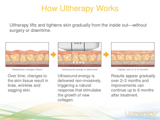 How does Ultherapy work?