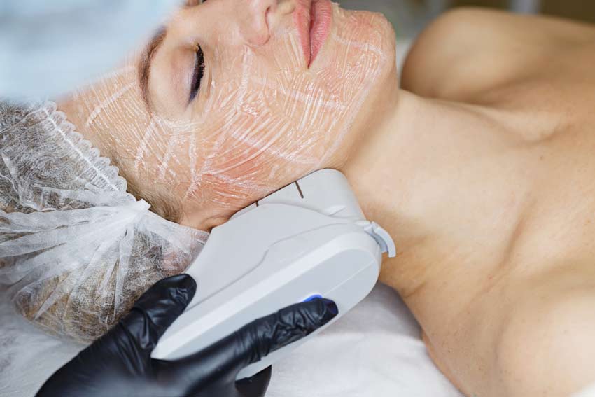 Laser Skin Rejuvenation