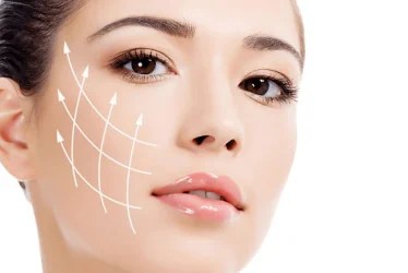 Threadlift is a minimally invasive procedure that is an alternative to facelift surgery. This procedure is done to tighten the skin, by using medical-grade thread, giving the skin a “lift”.